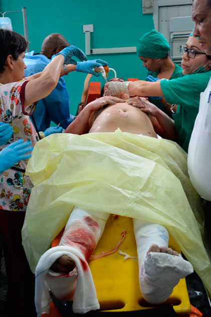 Sobreviviente de accidente aéreo es antendida en hospital Calixto García, de La Habana. Sobreviviente de accidente aéreo es antendida en hospital Calixto García, de La Habana.