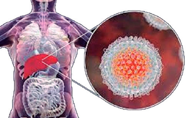 Hígado humano y hepatitis.