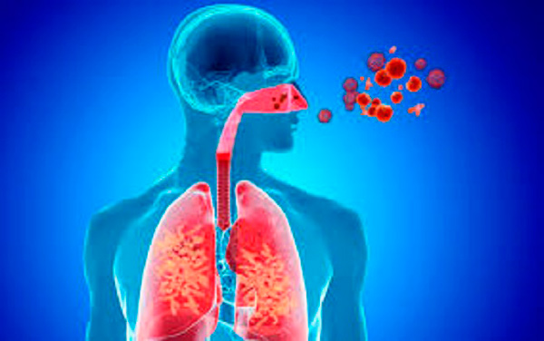 Esquema de las Infecciones Respiratorias Agudas. Esquema de las infecciones respiratorias agudas.