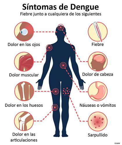 Sí­ntomas del dengue.