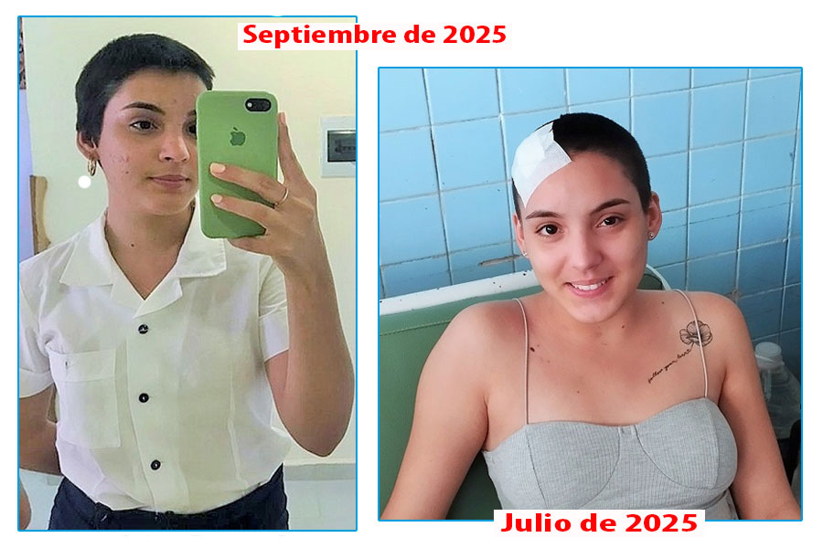Este 1.o de septiembre, Natalia ultimaba los detalles para partir al primer día de clases de su duodécimo grado en Caibarién. A la dereacha, la imagen tomada minutos antes de marchar a su hogar tras recibir el egreso hospitalario.