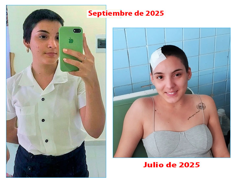 Este 1.o de septiembre, Natalia ultimaba los detalles para partir al primer día de clases de su duodécimo grado en Caibarién. A la dereacha, la imagen tomada minutos antes de marchar a su hogar tras recibir el egreso hospitalario.